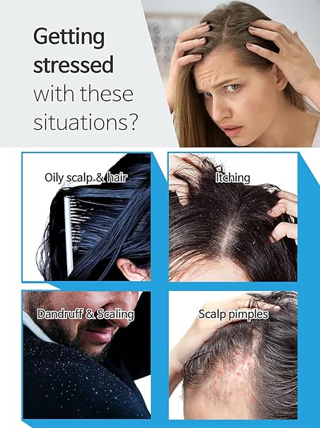 BallVic Sebo Shampoo – 17.6 oz | Korean Balancing Shampoo with Zinc & Herbal Complex