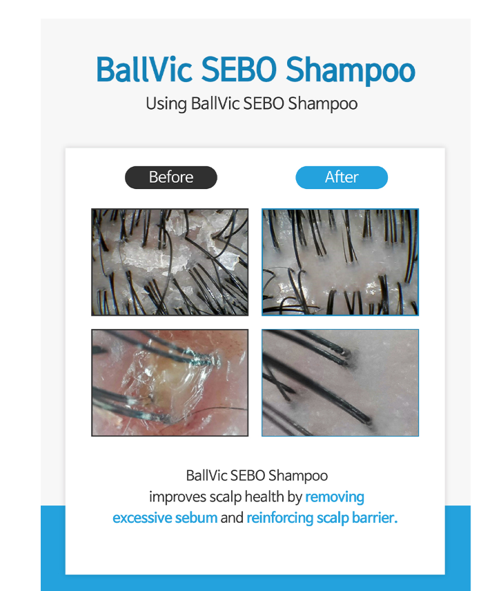 BallVic Sebo Shampoo – 17.6 oz | Korean Balancing Shampoo with Zinc & Herbal Complex
